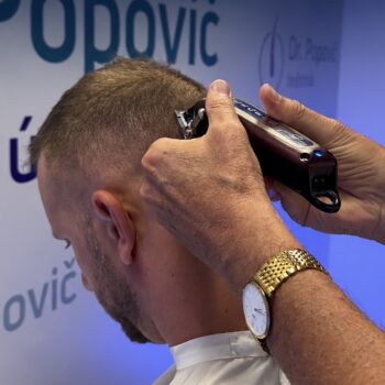 Rovnaký zákrok, iná príprava: prečo darcovskú zónu neholím každému rovnako